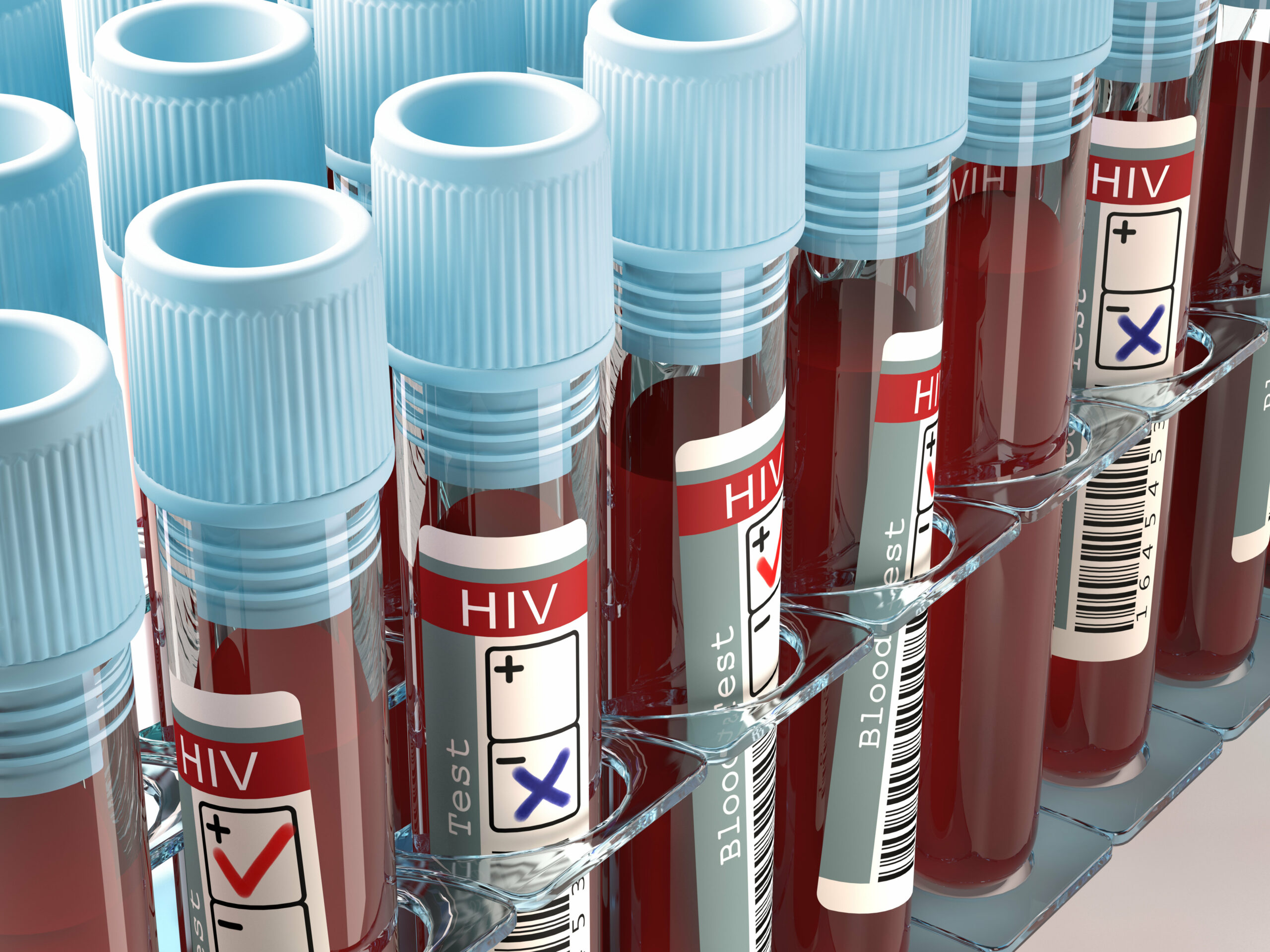 Muestras de sangre positivas y negativas a VIH